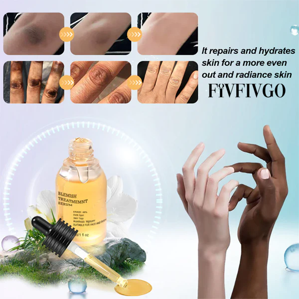 Serum de tratamento de manchas