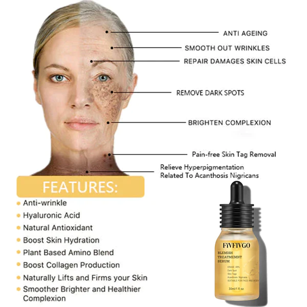 Serum de tratamento de manchas