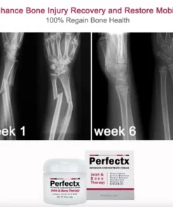 CC™ Perfectx Joint And Bone Therapy Cream