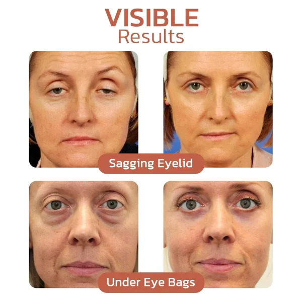 Crocodile Oil Healing & Repairing Eye Cream - Image 4