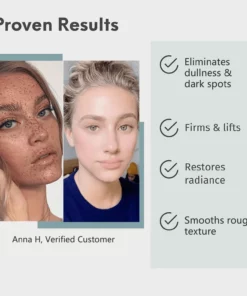 Alternative view of Faues™ Hautaufhellendes Anti-Flecken-Serum