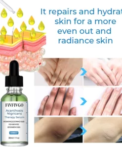 Fivfivgo™ Acanthosis Nigricans Therapy Serum