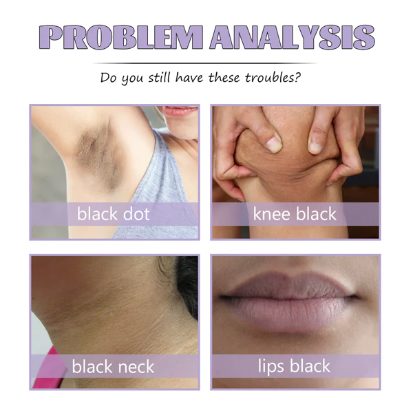 Fivfivgo™ Collagen Acanthosis Nigricans Therapiecreme - Image 6