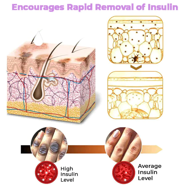 Fivfivgo™ Collagen Acanthosis Nigricans Therapiecreme - Image 4