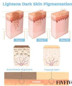 Fivfivgo™ Collagen Boost Acanthosis Nigricans Therapiecreme