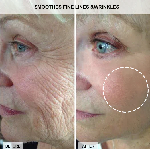 Fivfivgo™ Collagen-Boost Lift Anti-Aging Cream - Image 4