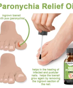 Fivfivgo™ FootCure Removal Paronychia Gel