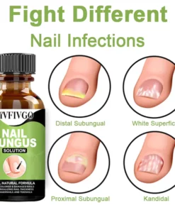 Fivfivgo™ FootCure Removal Paronychia Gel