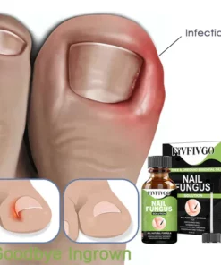 Fivfivgo™ FootCure Removal Paronychia Gel