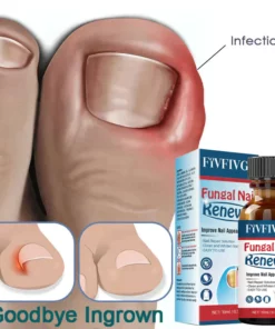 Fivfivgo™ Gel zur Behandlung von Nagelpilz