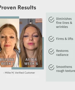 Alternative view of Fivfivgo™ Luxury Collegan Boost Hyaluronic Acid Anti-Aging Serum