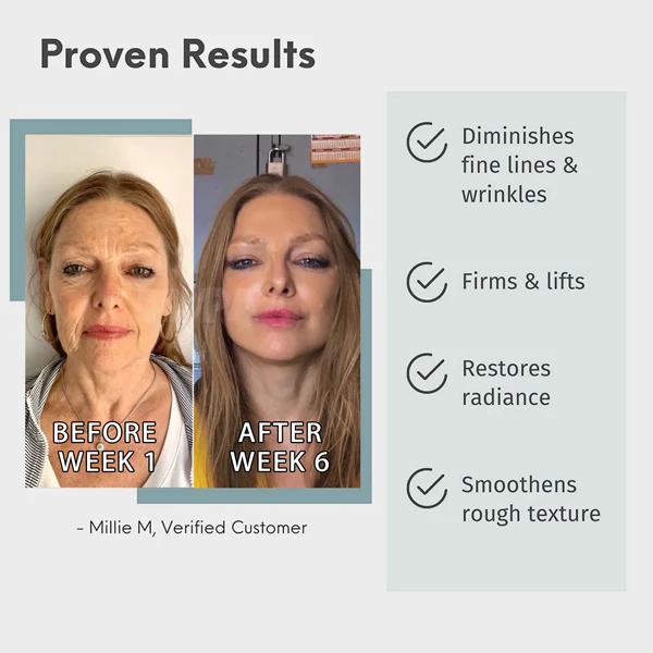 Luxus-Hyaluronsäure-Anti-Aging-Serum - Image 6