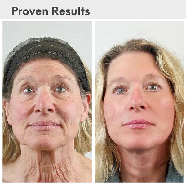 Luxus-Hyaluronsäure-Anti-Aging-Serum - Image 5