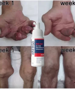 Fivfivgo™ TherapyX Joint & Bone Therapy Foam