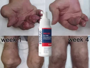 Fivfivgo™ TherapyX Joint & Bone Therapy Foam