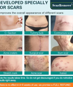 Flashing™ Advanced Scar Spray For All Types of Scars