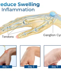 Alternative view of GFOUK™ Deutsches Handgelenkssehnenentzündungs-Therapieöl