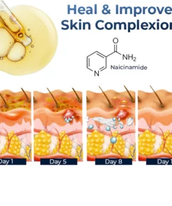 GFOUK™ Eczema Therapy Spray