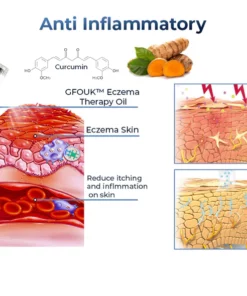 GFOUK™ Ekzem-Therapie-Spray