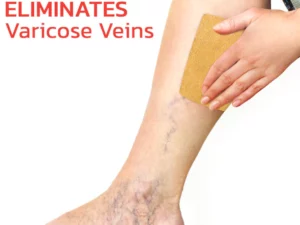 GFOUK™ VeinLess Immediate Relief Herbal Patch