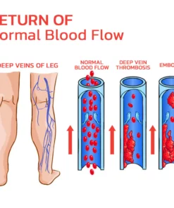 GFOUK™ VeinLess Immediate Relief Herbal Patch