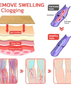 GFOUK™ VeinLess Immediate Relief Herbal Patch