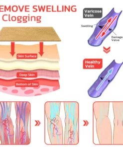 GFOUK™ VeinLess Kräuterpflaster zur sofortigen Linderung