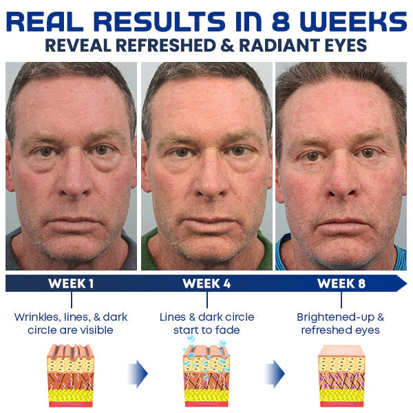 Awaken Peptide Depuffing Eye Gel - Image 6