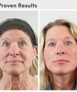 JUENOW® Luxury Hyaluronic Acid Anti-Aging Serum