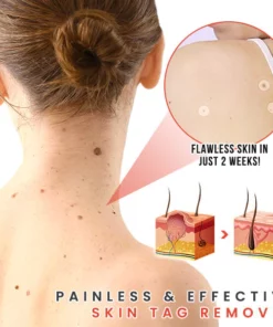 Juenow™ MicroDarts TAG'Gone Patch