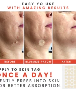 Juenow™ MicroDarts TAG'Gone Patch