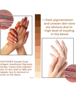 LIANTIAGE® Korean Snail Collagen Acanthosis Nigricans Therapy Cream