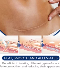 MEDix™ Advanced Silicone Scar Gel