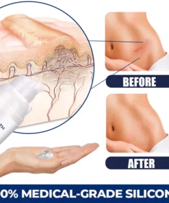 MEDix™ Advanced Silicone Scar Gel