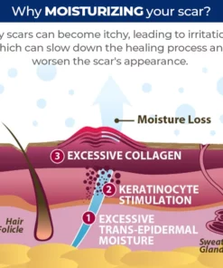 MEDix™ Advanced Silicone Scar Gel