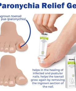 NARC™ Removal Paronychia Gel