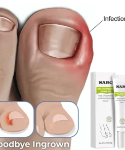 NARC™ Removal Paronychia Gel