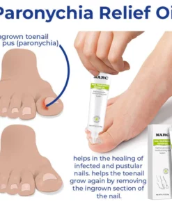 Alternative view of NARC™ Removal Paronychia Oil