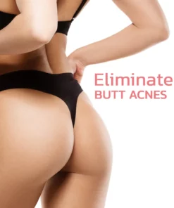 Alternative view of NEWSKIN™ Pimple & Acne Treatment Roll On Serum