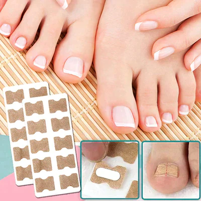 Nail Correction Patches - Image 2