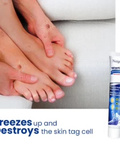 NeigeusesTM WartsOff Instant Blemish Removal Cream