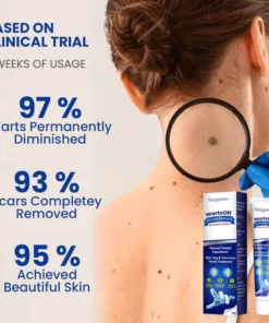 NeigeusesTM WartsOff Instant Blemish Removal Cream