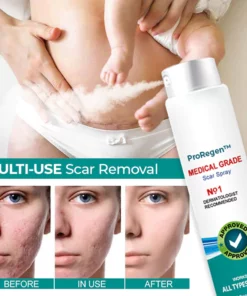 ProRegen™ Medical Scar Removal Spray