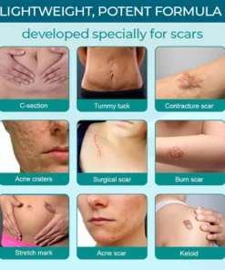 ProRegen™ Medical Scar Removal Spray