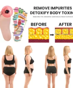 Proring™ Acupressure Toe Ring