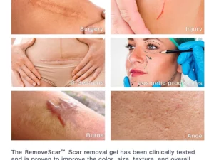 RemoveScar™ Advanced Scar Remove gel