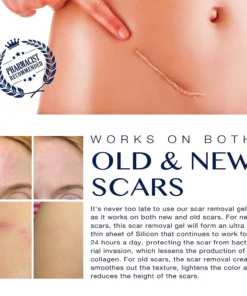 RemoveScar™ Advanced Scar Remove gel
