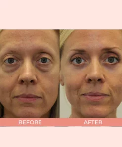 Retinol Polypeptide Repair Eye Cream