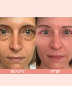 Retinol Polypeptide Repair Eye Cream