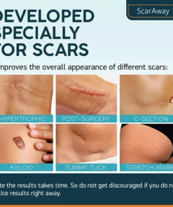 ScarAway® Advanced Scar Gel
